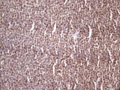 Immunohistochemistry: IKK epsilon/IKBKE Antibody (OTI3C5) [NBP2-46047]
