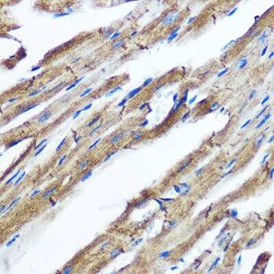 Immunohistochemistry-Paraffin: IKK epsilon/IKBKE Antibody (5N4J8) [NBP3-16192]