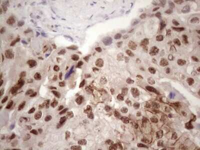Immunohistochemistry: IKK epsilon/IKBKE Antibody (OTI3C5) - Azide and BSA Free [NBP2-71490]