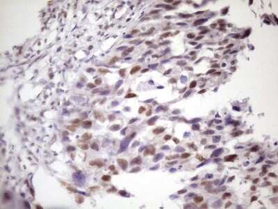 Immunohistochemistry: IKK epsilon/IKBKE Antibody (OTI3C5) - Azide and BSA Free [NBP2-71490]