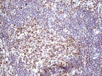 Immunohistochemistry: IKK epsilon/IKBKE Antibody (OTI3C5) - Azide and BSA Free [NBP2-71490]