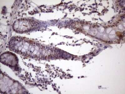 Immunohistochemistry: IKK epsilon/IKBKE Antibody (OTI3C5) - Azide and BSA Free [NBP2-71490]