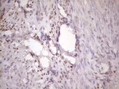 Immunohistochemistry: IKK epsilon/IKBKE Antibody (OTI3C5) - Azide and BSA Free [NBP2-71490]