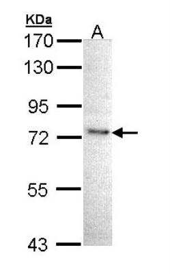 Western Blot: IKK epsilon/IKBKE Antibody [NBP1-33052]