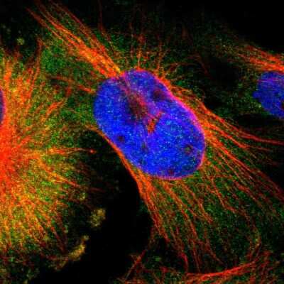 Immunocytochemistry/ Immunofluorescence: IKK gamma Antibody [NBP1-84681]