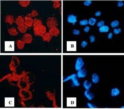 In vivo assay: IKK gamma Inhibitor Peptide Set [NBP2-26504]