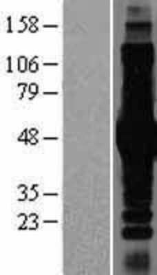 Western Blot: IKK gamma Overexpression Lysate [NBP2-04192]