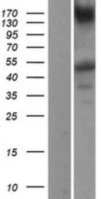 Western Blot: IKK gamma Overexpression Lysate [NBP2-04253]