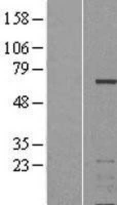 Western Blot: Aiolos/IKZF3 Overexpression Lysate [NBL1-11893]