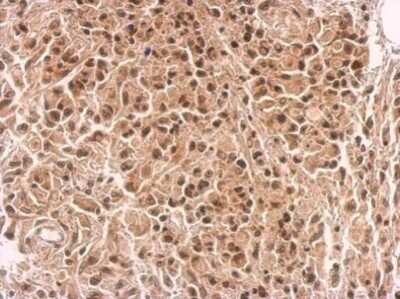 Immunohistochemistry-Paraffin: ZNFN1A4 Antibody [NBP2-42867]