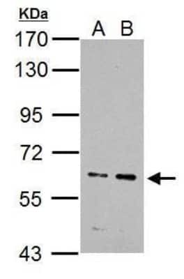 Western Blot: ZNFN1A4 Antibody [NBP2-42867]