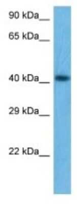 Western Blot: IKZF5 Antibody [NBP3-10970]