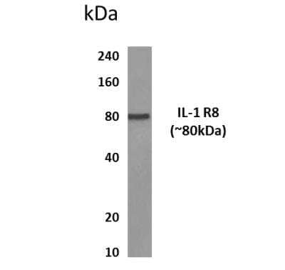 Western Blot: IL1RAPL1 Antibody (MM0353-3R16)Azide and BSA Free [NBP2-11648]