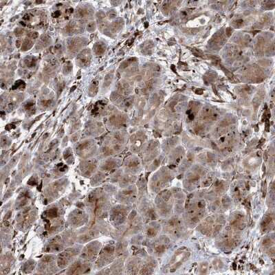 Immunohistochemistry-Paraffin: IL1RAPL2 Antibody [NBP2-38282]