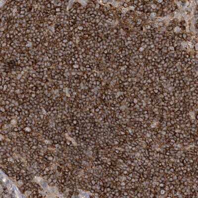 Immunohistochemistry-Paraffin: IL1RAPL2 Antibody [NBP1-81598]