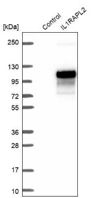 Western Blot: IL1RAPL2 Antibody [NBP1-81598]