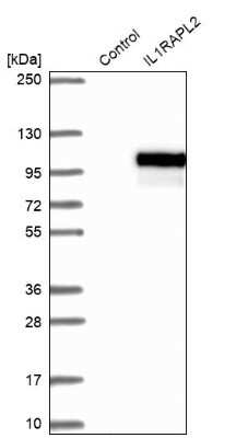 Western Blot: IL1RAPL2 Antibody [NBP2-38282]