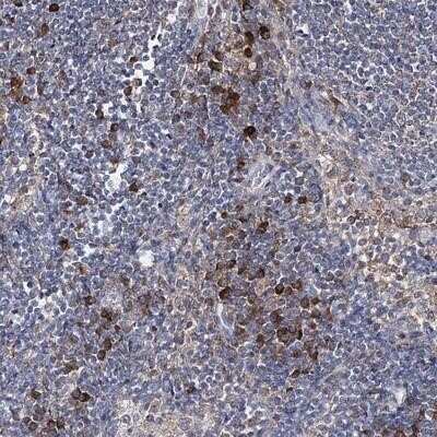 Immunohistochemistry-Paraffin: IL-1 RAcP/IL-1 R3 Antibody [NBP1-86793]