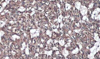 Immunohistochemistry-Paraffin: IL-1 RAcP/IL-1 R3 Antibody [NBP2-16946]