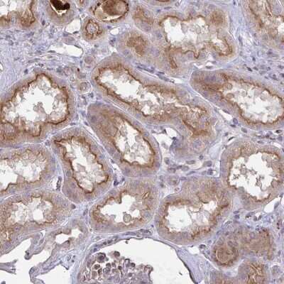 Immunohistochemistry-Paraffin: IL-1 RI Antibody [NBP2-48500]