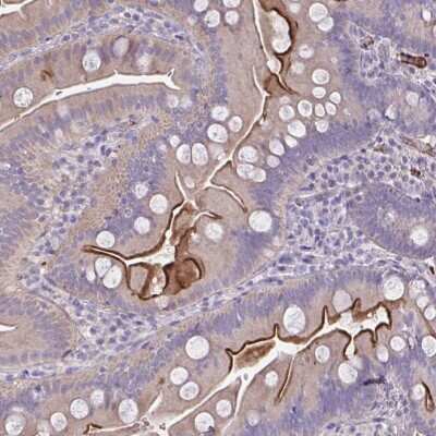 Immunohistochemistry: IL-1 RI Antibody [NBP2-48589]