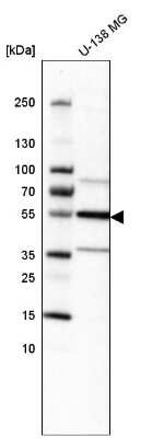 Western Blot: IL-1 RI Antibody [NBP2-48500]