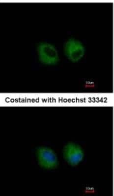 Immunocytochemistry/ Immunofluorescence: IL-1 RII Antibody [NBP1-32681]