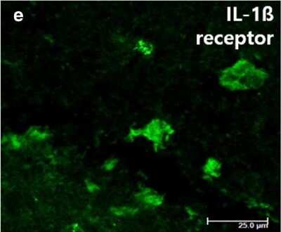 Immunohistochemistry: IL-1 RII Antibody [NBP1-32681]