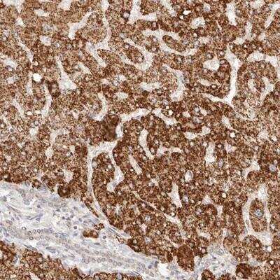 Immunohistochemistry: IL-1 RII Antibody [NBP1-86551]