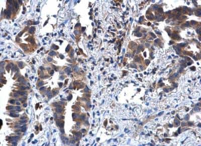 Immunohistochemistry-Paraffin: IL-1 RII Antibody [NBP1-32681]