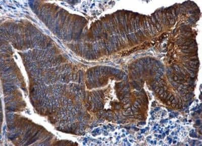 Immunohistochemistry-Paraffin: IL-1 RII Antibody [NBP1-32681]