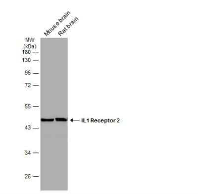 Western Blot: IL-1 RII Antibody [NBP1-32681]