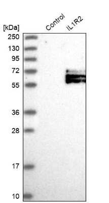 Western Blot: IL-1 RII Antibody [NBP1-86550]