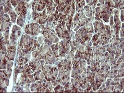 Immunohistochemistry: IL-1 alpha/IL-1F1 Antibody (OTI2F8) [NBP2-45400]