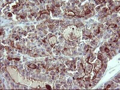 Immunohistochemistry: IL-1 alpha/IL-1F1 Antibody (OTI2F8) [NBP2-45400]