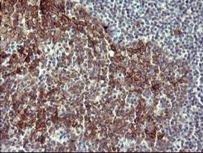 Immunohistochemistry: IL-1 alpha/IL-1F1 Antibody (OTI2F8) [NBP2-45400]