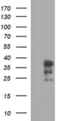 Western Blot: IL-1 alpha/IL-1F1 Antibody (OTI2F8) [NBP2-45400]