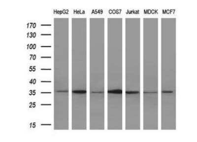 Western Blot: IL-1 alpha/IL-1F1 Antibody (OTI2F8) [NBP2-45400]