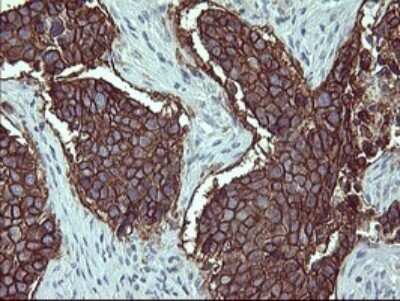 Immunohistochemistry: IL-1 alpha/IL-1F1 Antibody (OTI2F8) - Azide and BSA Free [NBP2-71021]
