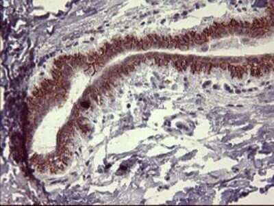 Immunohistochemistry: IL-1 alpha/IL-1F1 Antibody (OTI2F8) - Azide and BSA Free [NBP2-71021]