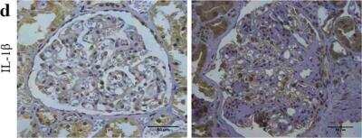 Immunohistochemistry: IL-1 beta/IL-1F2 Antibody - BSA Free [NBP1-19775]