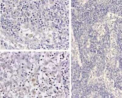 Immunohistochemistry: IL-1 beta/IL-1F2 Antibody [NB600-633]