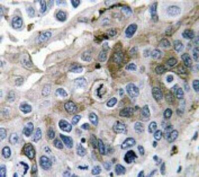 Immunohistochemistry: IL-1 beta/IL-1F2 Antibody - BSA Free [NBP1-19775]