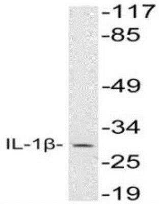 Western Blot: IL-1 beta/IL-1F2 AntibodyBSA Free [NBP1-19775]