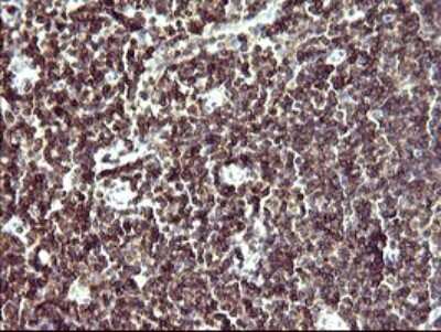 Immunohistochemistry: IL-10R alpha Antibody (OTI1D10) [NBP2-46049]