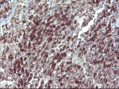Immunohistochemistry: IL-10R alpha Antibody (OTI1D10) [NBP2-46049]