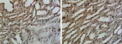 Immunohistochemistry-Paraffin: IL-10R alpha Antibody (RM0101-9E12) - Azide and BSA Free [NBP1-22459]