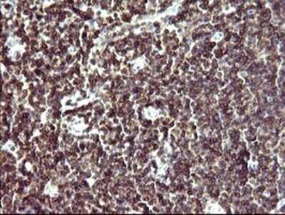 Immunohistochemistry: IL-10R alpha Antibody (OTI1D10) - Azide and BSA Free [NBP2-71030]