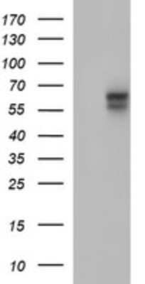 Western Blot: IL-10R alpha Antibody (OTI1D10)Azide and BSA Free [NBP2-71030]