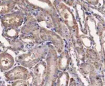 Immunohistochemistry-Paraffin: IL-10R alpha Antibody (OTI1D10) [NBP2-46049]